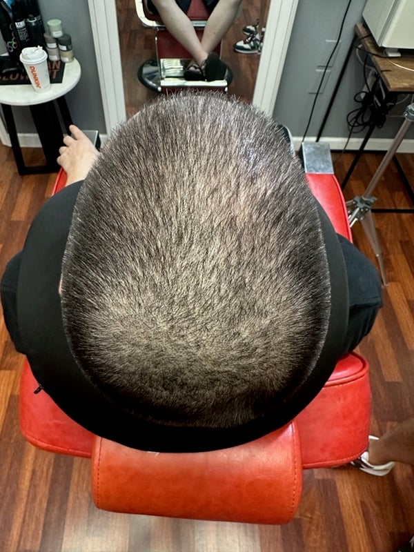 Density Treatment for Fullness​